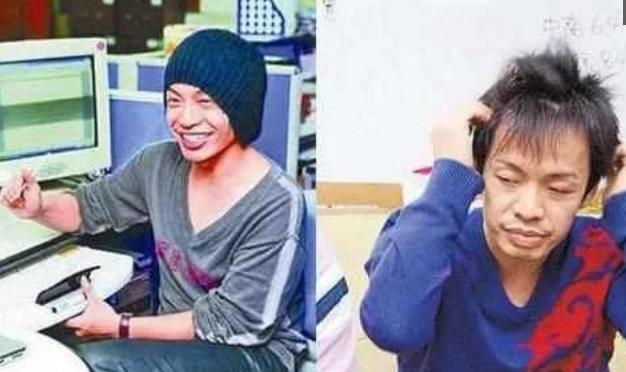 明星整容前后,變化、爭(zhēng)議與理解的深度探討