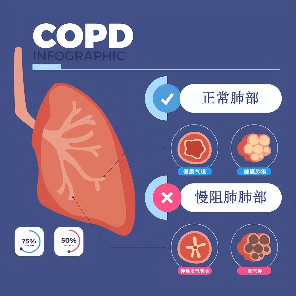 慢阻肺最新三聯藥物解析,全面解讀最新治療藥物!??