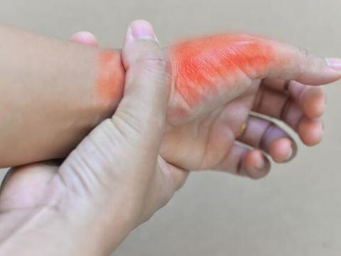 最新癢痛現(xiàn)象,社會關(guān)注與觀點(diǎn)爭議